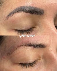 توريد شفه ٢٥ ازالة تاتو مع نبات شعر ٥٠الف  الحجز 07804524701