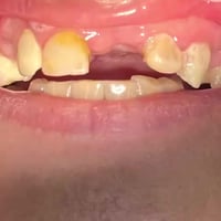 تركيب زاركون • هند التميمي • شارع الأطباء