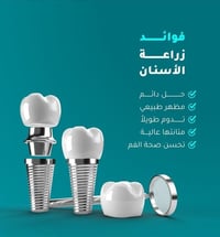 ابتسامتك تستحق الإتقان 👌 زراعة أسنان بتقنيات حديثة ونتائج طبيعية 100%....