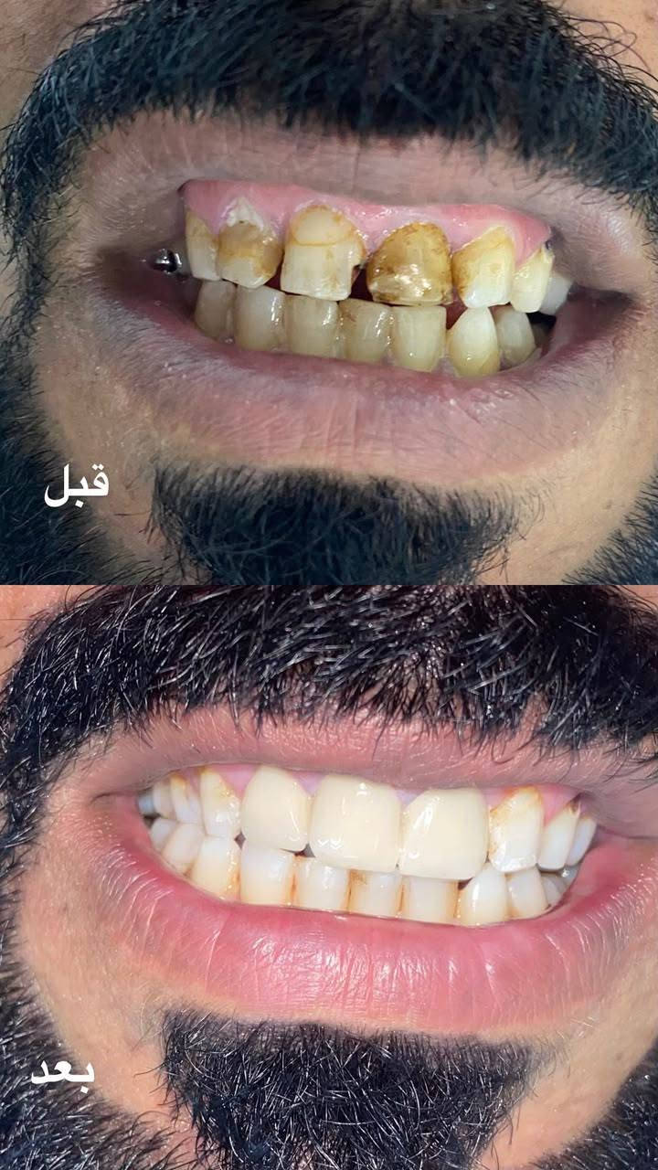 توجد طبيبة أسنان
العنوان : الحاج علي مقابل ثانوية الشهيد حسن الزيدان 
رقم الحجز : *********** 
أوقات الدوام طيلة ايام الأسبوع 
من 3 عصرا إلى 7 مساءاً
