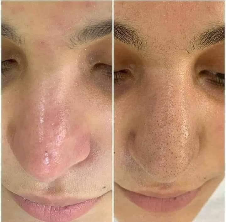 اهلا وسهلا  عروض  نار
عروض رأس السنه🎉 
عروض مميزه💃🏻🎊
اسعارناً مناسباً 📍✨
عروس حنه وزفه 225💃🏻💃🏻💃🏻
فقط زفه 125🎈💃🏻
فقط حنه 100🎎🔥🎉🎊🎈💃🏻
المدعوات 25🎊💃🏻🎈🎈
تنظيف البشرة هايدرو ب10 💃🏻🎊
تنظيف البشرة ملكي ب15🎉
تنظيف  اليد 8🥳💃🏻💃🏻💃🏻💃🏻💃🏻
حفافة 5
شمع للوجه  8
بديكير 10 مع املاح طبيعية 
الماكير 25🎈🎈🧸
سحب لون شعر قصير 10 واسط 20فما فوق حسب طول الشعر
صبغ شعر قصير جداً 15 💃🏻🎎🔥المتن 20 الوسط 25 الطويل حسب طول الشعر 
ميش كثيف قصير 20 فما فوق حسب طول الشعر 🎎🔥💃🏻
تسريح الشعر يخلي شعرج سرح حسب طول الشعر 
قص 5 اي قصه 
معالج لترميم وتغذية الشعر القصير 25 فما فوق حسب طول الشعر🎉🎊🎈
اهلا وسهلا بلجميع 
صالون الين
العنوان//كربلاء حي الرباب قرب سيد سماعيل 
الحجز //***********
***********
