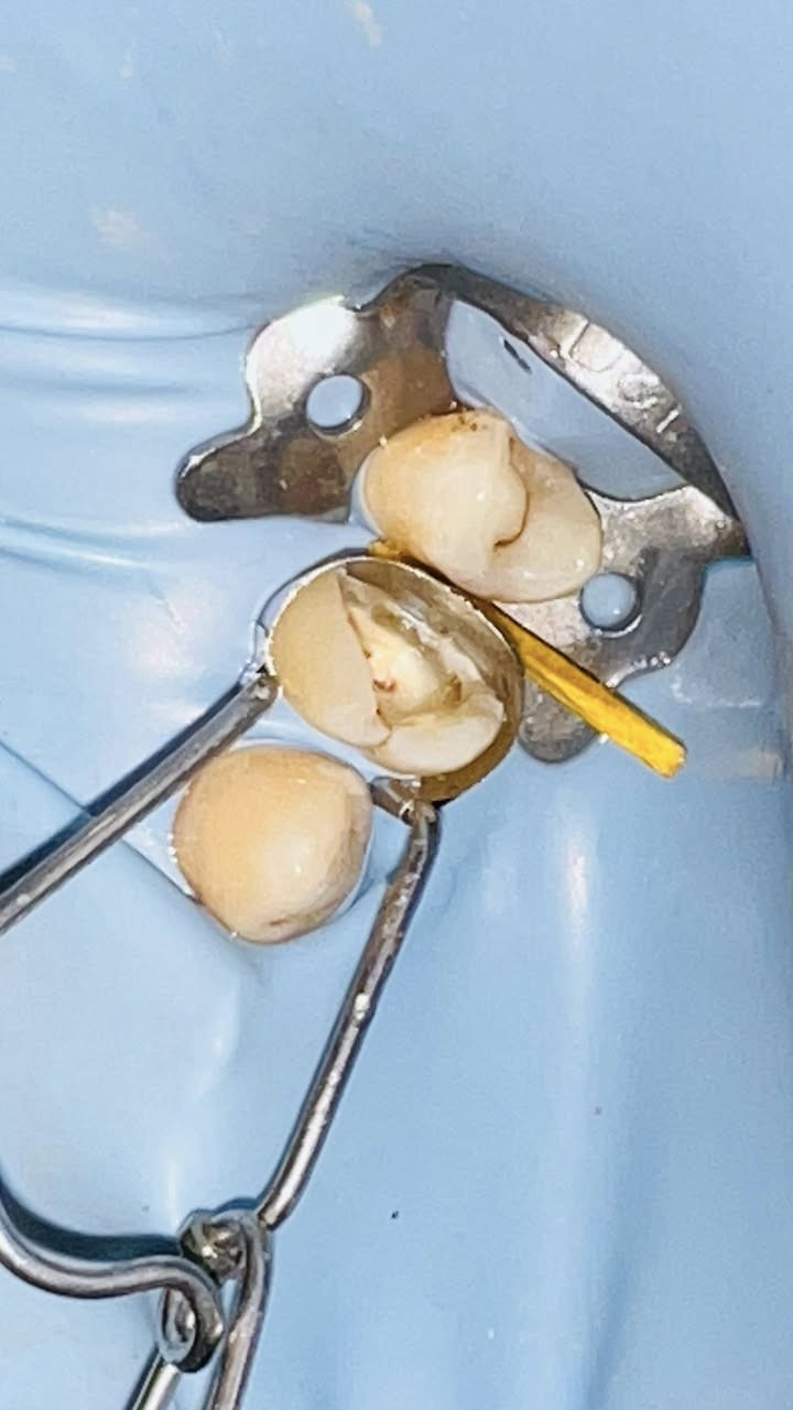 نود اعلامكم عيادة طب الاسنان الدكتور محمد سيكون متواجد اليوم من الساعة 2 الى 6
حشوات جذور.حشوات تجميلية.تركيب الاسنان.تنظيف الاسنان

العنوان/الشورة القصبة داخل القيصريه شارع 60 

للحجز والاستفسار:*********** انور العبيدي
