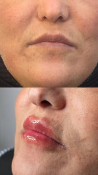 فلر شفة • شارع المجمعات • حي العدالة