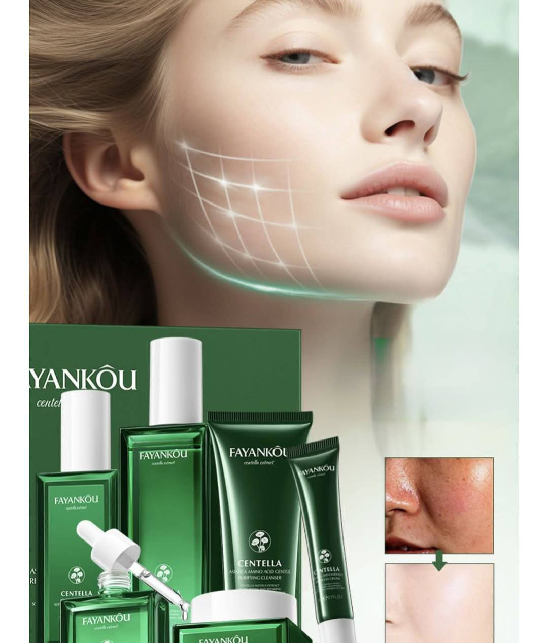 🌿 سينتيلا أسياتيكا - المجموعة المثالية للعناية بالوجه ! 🌿

💖 دللي بشرتك بقوة الطبيعة!
المجموعة المليئة بخلاصة سنتلا أسياتيكا تهدئ البشرة وترطيبها وتعيدها، تعزز حاجز البشرة وتترك أثرًا لطيفًا وصحيًا ومشرقًا.

✨ المجموعة تشمل:
✔️ سيروم الوجه - لتغذية وترطيب عميق ✔️
✔️ كريم الوجه - لمرونة البشرة ونعومتها
✔️ كريم العين - لتقليل الهالات السوداء والخطوط الدقيقة
✔️ منظف - للتنظيف العميق وتنظيف البشرة

💆 ♀ مثالي للروتين اليومي!
✅ يهدئ البشرة ويحميها
✅ عمل مضاد للأكسدة
✅يساعد على تقليل حب الشباب والتهيج
✅ يرطب ويوازن لون البشرة

السعر ٣١  الف
توجد خدمة توصيل إلى جميع المحافظات ٤ الاف
#فولو #فولومي #فولورز #اكسبلور_فولو #ضيفوني #الاكسبلور_فولو💕 #بيع_لايكات #لايكاتكم_تسعدني #حب #تعليقات #تعليقاتكم_تسعدني😍 #تعليق #تعليقاتكم_تسعدني #متابعة_للبيج #ضيفو #اكسبلور #لقطة #لايك #دعم #تفاعل #لايكات #كومنت #كومنتات #اكسبلور


**إذا كنت صاحب هذا الإعلان وتريد حذفه لأي سبب، رجاءا أرسل رسالة إلى الدعم الفني**