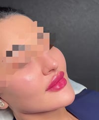 التغيير الشامل يمي والكل يدلل 400 الف 10 سيسي مع ابرة العنبر   للاستفس...