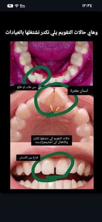 علاج اسنان • مجاناً • الحلة شارع 40