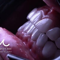 ⁨ ⁨ عروض العيد ع الابتسامة داخل عيادة مريمانا كلينيك 🔥🔥⁩للحجز والاستفس...