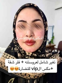 تغير شامل لعروستنه + فلر شفة +مكس الvip للنضارة😍😍 للحجز والاستفسار/077...