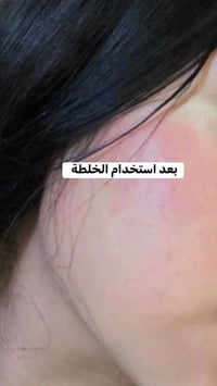 خلطة بشرة • تبيض بشرة • تفتيح بشرة • علاج تجاعيد • علاج هالات • علاج ت...