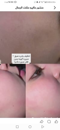 مشتل • قرب محطة الكهرباء • حفافه وتنظيف بشرة
