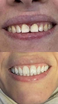 عروض خاصه على قسم الأسنان والتجميل لمدة اسبوع كامل😍 للحجز والاستفسار ع...