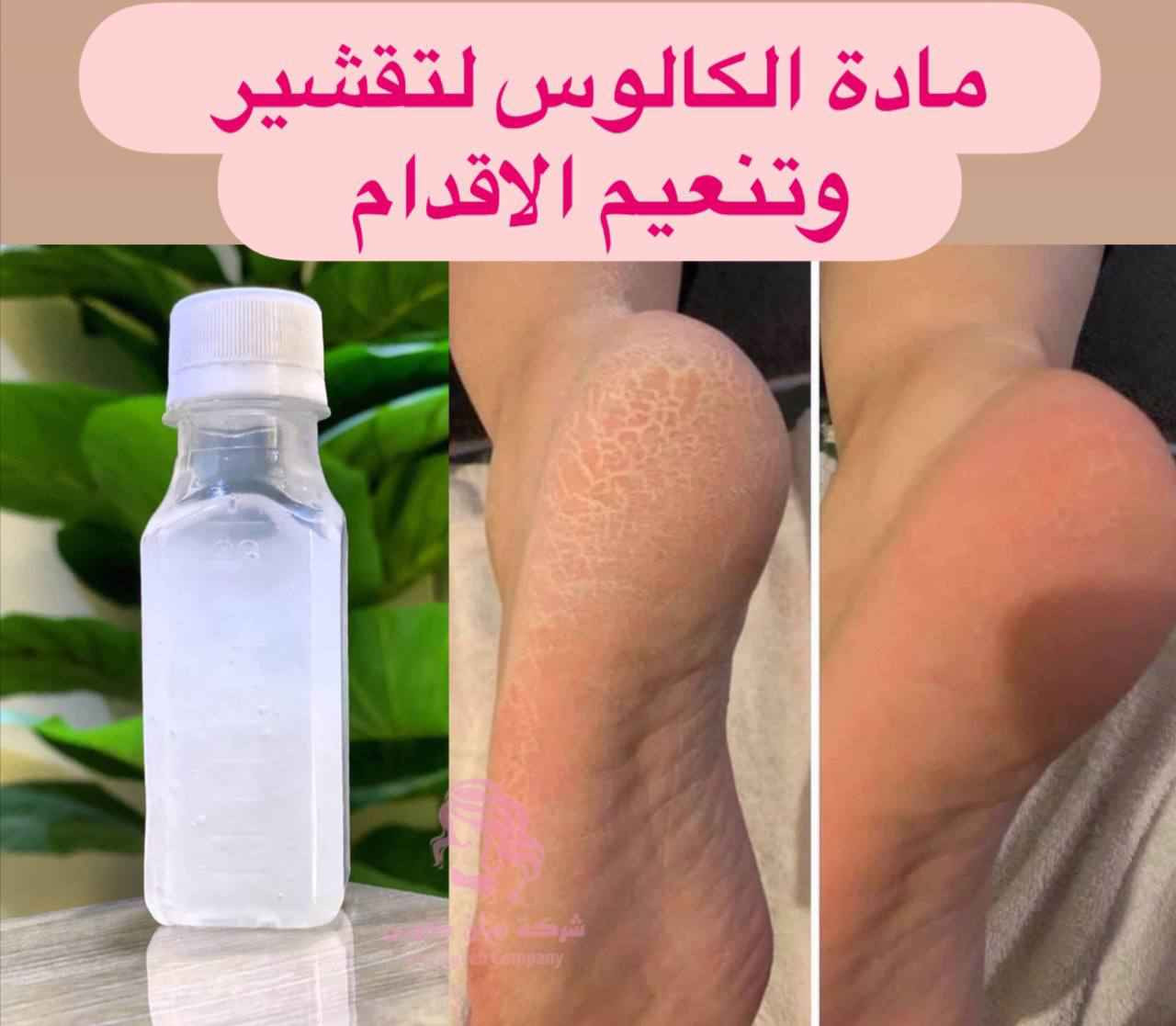 كالوس لازالة الجلد الميت و تشققات القدم
CALLUS REMOVER
ميحتاج تروحين مركز تجميل او صالون توفر منتج ( كالوس ) للقدم تگدرين تشتغليه بالبيت وبكل سهوله ♥️
وضيفته يشيل الجلد الخشن الي بالكعب خلال دقائق 👍✋
مزيل مسامير القدم - قولي وداعًا لتصلب الجلد والجلد الميت. مثل امتلاك باديكير احترافي بدون تكلفة عالية.
القضاء على الناجم في المنزل! - مزيل الجلد الميت هذا للقدمين يعمل خلال 3 إلى 5 دقائق! ببساطة انقع قدميك في حوض الاستحمام أو في حوض قدم، انتظر ثم استخدم أداة تنظيف القدم المفضلة لديك أو حجر خفاف القدم لإزالة مسامير القدم بلطف.
استخدمه مع مقشِّر قدمك المفضل - لا يقتصر على إزالة مسامير القدم فحسب، بل يجعل قدميك ناعمتين وناعمتين للطفل.

كالوس تقشير اقدام  فوري وفعلي للاقدام 
  طريقة الاستخدام:
   تغسل الاقدام بالماء  والصابون وتنقع في ماء ساخن. لمدة 5 دقائق  ومن  ثم تجفف  وتوضع قطرات من الكالوس على الجلد الخشن والتشققات وتدلك بواسطة شريحة قطنية وتترك لمدة 3 دقائق فقط وبعدها يستعمل   حجر او مبرد لازالة الجلد الميت ملاحظة يفضل استخدام قفازات بلاستيكية اثناء الاستخدام
المنشأ اماراتي اصلي 💯   
🚘 يوجد خدمة توصيل لجميع محافضات العراق بغداد, العراق


**إذا كنت صاحب هذا الإعلان وتريد حذفه لأي سبب، رجاءا أرسل رسالة إلى الدعم الفني**