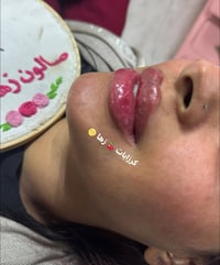 عروض قنبله  الموسم عروض لمده محدوده فقط  على جميع الأقسام لمده محدوده ...