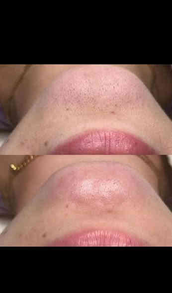 صباح الخير بنات عروض شهر ل١٢ لحد رأس السنة الميلاديه
💐💐💐💐🏵️🏵️🏵️🏵️🏵️

نبدي بالصلاه على رسولنا الكريم محمد صل الله عليه وآل وسلم وعلى آل بيت محمد 🤲

🧑‍🎄🧑‍🎄🧑‍🎄🧑‍🎄🧑‍🎄
1_ حف الوجه خيط 10 الف + هديه قناع النضاره للبشره 🤗
🧑‍🎄🧑‍🎄🧑‍🎄🧑‍🎄

2_ حف الوجه شمع وخيط 10 الف + قناع النضاره هديه 😍
🧑‍🎄🧑‍🎄🧑‍🎄🧑‍🎄🧑‍🎄

3_ حف الوجه شمع وخيط مع رقبه وجه وكفه هههههه 15 الف + هديه قناع النضاره البشره 🥰
🧑‍🎄🧑‍🎄🧑‍🎄🧑‍🎄

4_ قص الكذله مجانا 😘
🧑‍🎄🧑‍🎄🧑‍🎄🧑‍🎄

5_ غسل الشعر مع القص 10 الف

6_ تنظيف بشره عميق لازاله جلد ميت ورؤس سوداء ب15 الف 

7_ صبغ جذور الشعر 15 الف + قص أو تعديل الشعر هديه 🙋
🧑‍🎄🧑‍🎄🧑‍🎄🧑‍🎄

8_ صبغ شعر قصير للرقبه 25 الف+ ماسك معالج قص أو تعديل الشعر + شيسوار 🙆
🧑‍🎄🧑‍🎄🧑‍🎄🧑‍🎄

9_ صبغ الشعر للكتف 30 الف+ ماسك مع قص أو تعديل الشعر+ شيسوار💁
🧑‍🎄🧑‍🎄🧑‍🎄🧑‍🎄

12_ مع كل جلسه بروتين معالج مسرح هديه  قص الشعر  + قناع النضاره 🧏
🧑‍🎄🧑‍🎄🧑‍🎄🧑‍🎄

13_ تخصيل شعر قصير للرقبه 25 الف+ ماسك للشعر هديه 🧑
🧑‍🎄🧑‍🎄🧑‍🎄🧑‍🎄

15_ بديكير تنظيف القدم وازاله الجلد ميت 10الف 
 🦶🦶🦶🦶👋👋

16_ واكس الجسم كامل 40 الف مع منطقه البكيني 🌲🌲🌲🌲☃️☃️⛄🎄🎄🎍🎍

للحجز والاستفسار الاتصال على  واتساب 

*********** 

الي تحب تحجز تتواصل ويايه وادزلها موقع مالتي وربي يرزق الجميع يارب العالمين 

🎄🎄🎄🎄🎄🎄🎄🎄⛄⛄⛄⛄⛄⛄
