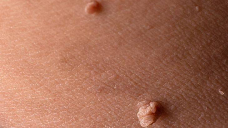 بنات بلشت عروووض اليزر سارعوا بل حجز🧡🩵❤️

قسم ليزر🤩
عروض ليزر 
كانديــــــلا ثلجي أحدث إصدار مع ضمان نتيجه بالفرق من أول جلسة 🤩😍
سعر المنطقة الوحدة ١٠الف 
جلستين ٢٠ الف فقط 
ثلاث جلسات ٣٠ الف فقط 
دفع مسبق 5جلسات 6 مجانا 
فول بدي جلسة ٧٥ الف بدون بطن وضهر ٦٠
فول بدي جلستين ١٠٠. الف دفع مسبق 

يله بنات نطلقو ليفوتكم العرض 
للحجز ***********
