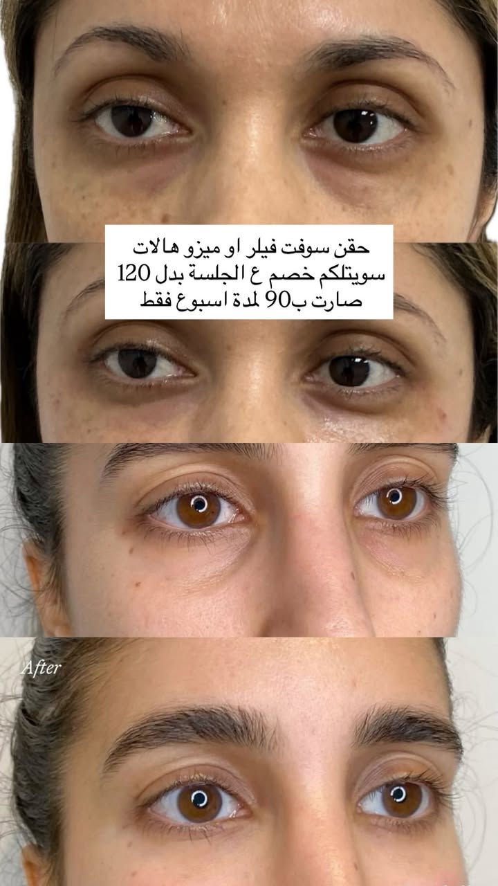 استغلوا العروض 
الموقع/ زيونة 710 خدمي دريم ستي 
للاستفسار/ ***********
