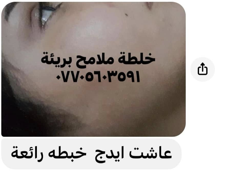 تم تجهيز خلطات لتبيض وتفتيح البشرة مع معالجة الكلف والتصبغات  ✨

بدون اي اضرار للبشرة خلي بشرتك اجمل مع خلطة ملامح بريئة
او راسلونا عالخاص


**إذا كنت صاحب هذا الإعلان وتريد حذفه لأي سبب، رجاءا أرسل رسالة إلى الدعم الفني**