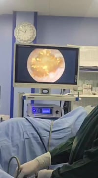 د.محمد عودة • مسالك بولية • الناصرية الحبوبي