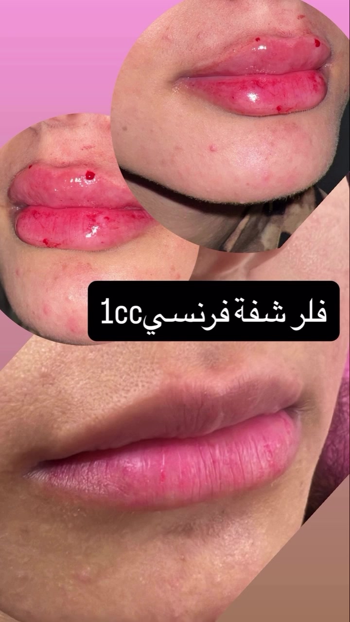 عروض سنتر اصيل بيوتي 
شارع الصالونات مجاور شركة اسيا سييل 
داخل بنايه باور جم
متواجدين اليوم الاثنين من الساعه ال١ ظهرا لغايه ال١٠ مساءا
ويوم غد الثلاثاء من ال١ لل ١٠ مساءا

للحجز والاستفسار ***********
