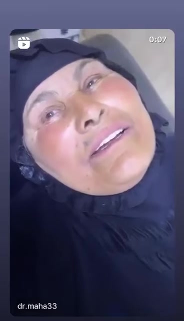 من اعمال عيادتنا…♥️🦷

ابتسامة هوليود نوع زيركون ايماكس للفكين علوي وسفلي 

بعد ان تمت المعالجة الاسنان سوينا ابتسامة مراجعتنا ب ابتسامة هوليود نوع زيركون ايماكس دائمية وثابته..🔥♥️☑️🦷🫶🏻
.
.
.

.
عنوان العيادة 🦷🤍✨

الرمادي _شارع المستودع _مجمع النخبة الطبي 
مبنى المحافظة مقابيل الضريبة مباشرة
 

للحجز والاستفسار الاتصال ع الرقم: ***********
او مراسلة صفحة العيادة 

أوقات الدوام من الساعة من ١١ صباحاإلى الساعة ٩ ليلا
