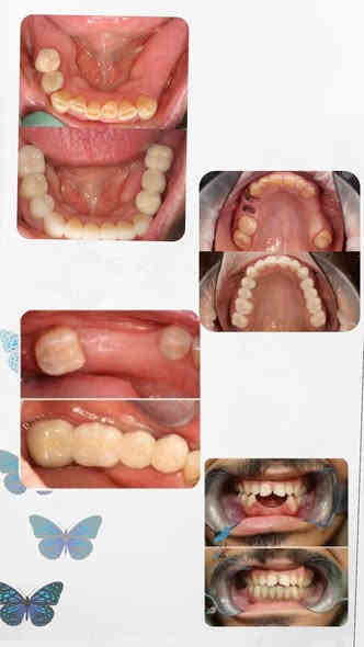 السلام عليكم ورحمة الله وبركاته 
الي يحتاج قلع جذور متبقية او تنظيف تكلسات او حشوات متواجدين بالعيادات وبشكل مجاني كامل 
موقع العيادة الحلة شارع اربعين مجاور صيدلية سلامتك
***********  للتواصل على هذا الرقم
