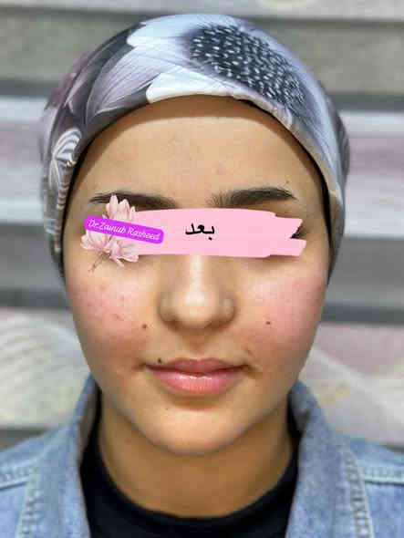 تغيير شامل بسيط السيسي الواحد 25 الف 

مركز ايفا الطبي 💉🦷

‏‪***********‬‏ 📱

مدينة الصدر الكياره قطاع٦٧ مقابل نادي الجولان الرياضي ⛹️
