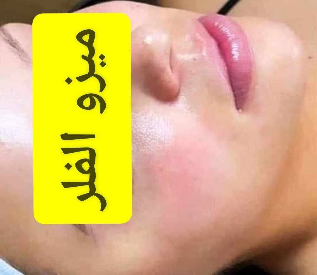 هلاو بناات 🥹🩷 العيد قرّب وماكو وقت نضيّعه، لازم نجهز ونلمع 😁✨ وياكم الكوافيره الأسطوره بشغلها 💖، بصراحة كل تفصيلة عندها تحسسك بالتميّز والفخامة 🥹😍، وأسعارها رهيبه وبالعروض الحلوه الكل رح ينبهر 😍🔥
موجوده داخل مدينه بسمايه، وعرض العيد وياها غيررر 😉 دللي نفسج وما تندمين👀💇‍♀️
العنوان: مجمع A7 📍🌸
أوقات الشغل: 10 صباحاً – 4 مساءً | 8 مساءً – 10 مساءً
للحجز: واتساب *********** أو على صفحة كوافيرة بسمايه مشو بيوتي  💕
@الجميع
