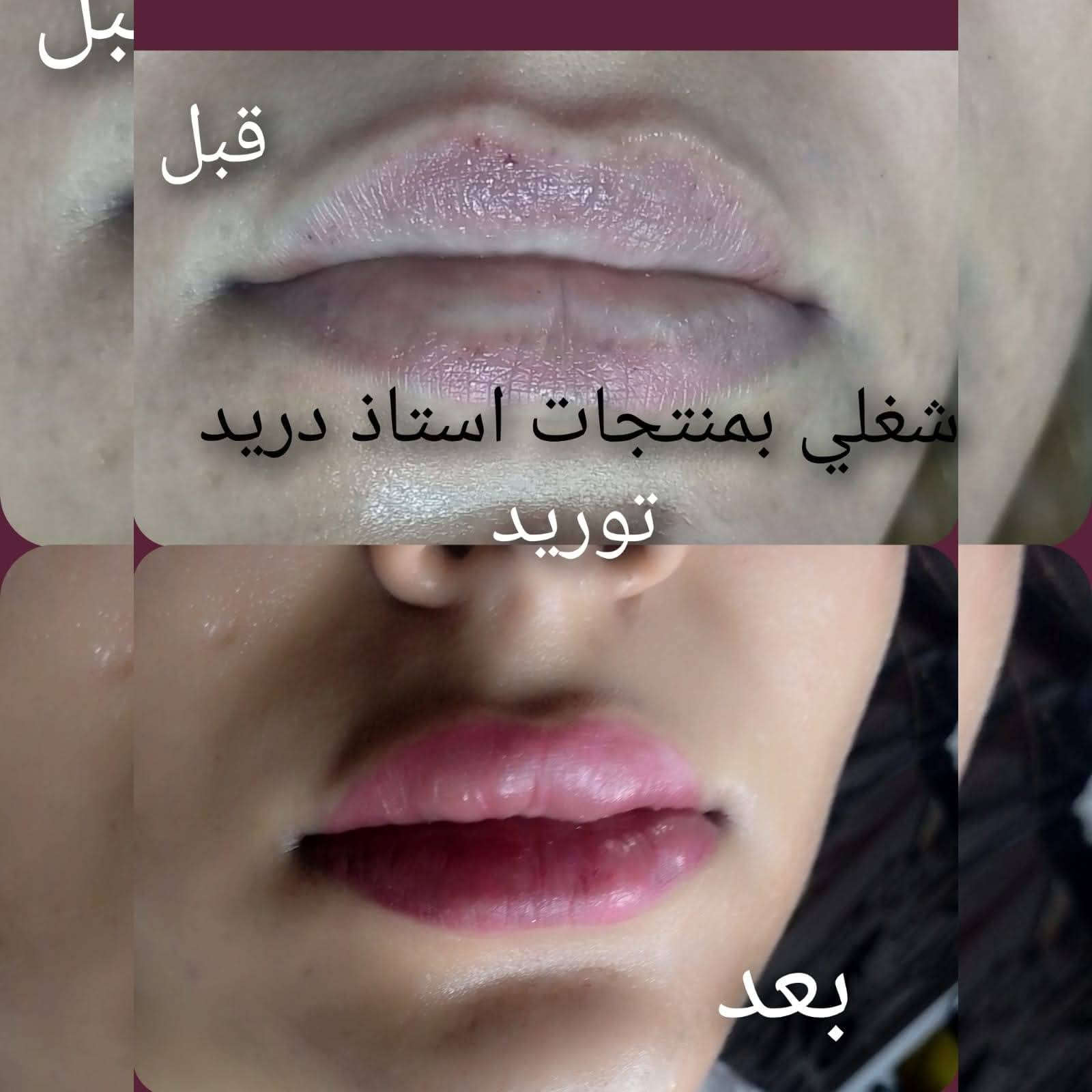 نتائج  توريد الشفه بأحبارنه 💕
تتوفر احبار التوريد    
وبسعر 15الف
توصيل بغداد ٥ محافظات 6
للحجز والأستفسار يرجى مراسلتي خاص  وتدللون ***********
