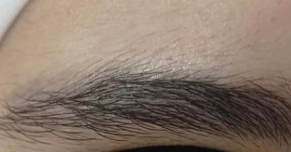 وهيك مع البتول لاقينا الحل الحلو لازاله التاتو الغامق المزعج 
لا تترددي في الاستشاره 
باسعار مناسبه ترضي الجميع 
اخلصي من شكل التاتو القديم المزعج معي انا وبس 
***********
