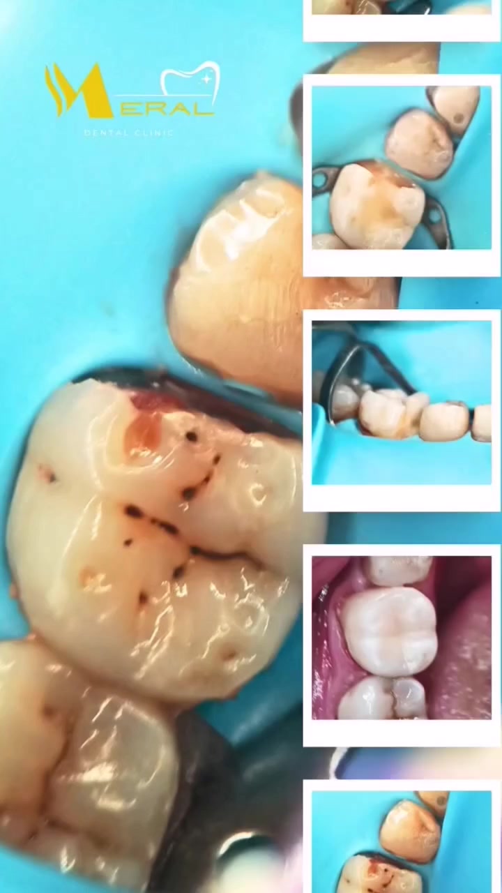 للحجز والاستفسار مراسله الصفحه او الاتصال على ***********
