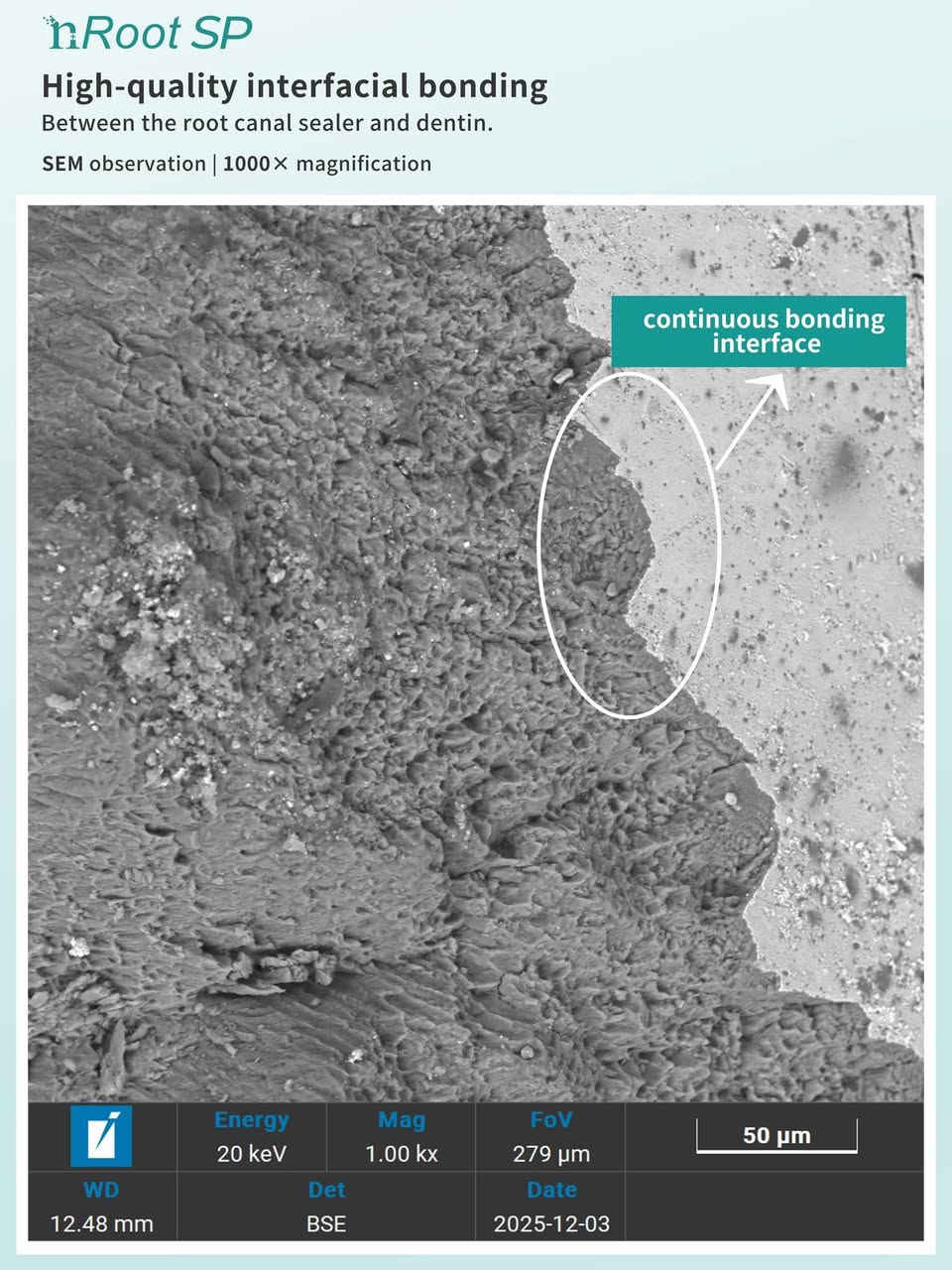 NRoot SP
Bioceramic Sealer 
من شركة ENP الرائدة عالمياً بمنتجاتها ودراساتها 
شنو يميّزه علميًا؟
‏🔹 Interfacial bonding قوي ويا العاج (Dentin)
حسب صور SEM:
 • يسوي bonding مستمر بين السيلر والعاج
 • يقلل الـ gaps والفراغات
 • يحسّن الإحكام (Seal) على المدى الطويل
‏🔹 Hydrophilic
يحب الرطوبة
يعني حتى لو القناة بيها رطوبة خفيفة، يشتغل بكفاءة عالية
(ميزة مهمة بحالات صعبة التجفيف)
‏🔹 Setting reaction حيوي
يتفاعل ويا الرطوبة ويسوي:
 • Calcium hydroxide
 • Calcium silicate hydrate
⬅️ هذا يساعد على:
‎ • التئام الأنسجة
‎ • تقليل الالتهاب
‎ • توافق حيوي عالي (Biocompatibility)
🔹 pH عالي بالبداية
 • تأثير مضاد للبكتيريا
 • مفيد بحالات الـ reinfection
🔹 انكماش شبه معدوم
على العكس من بعض السيلرات الراتنجية
⬅️ ثبات حجمي ممتاز
‏⬅️ Seal طويل الأمد

وين احنا؟📍📍‼️
دنتست ستور لمستلزمات طب الاسنان بغداد / باب المعظم / قرب فرع
مصرف الرافدين
للحجز والاستفسار:
0777 935 6962
0

