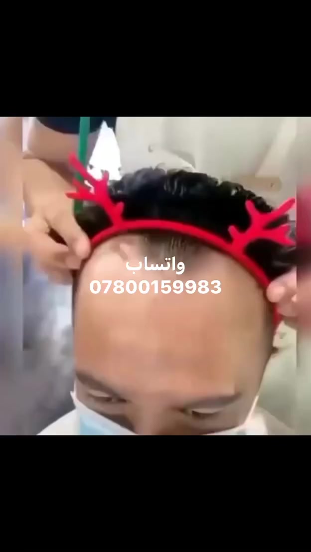 مقدمه امامية شعر طبيعي خام بشري
🤩متوفر مقدمه لاصق
🤩متوفر مقدمه كلبسات 
✨ وياها كارت الضمان ( صبغ قصر كوي غسل سيروم مشط تنفرك جميع الاتجاهات ) 
✨ملاحظة// ترهم رجالي وترهم نسائي 
…
واتساب *********** 
…

#مقدمة #طبيعي #صلع_الراس
