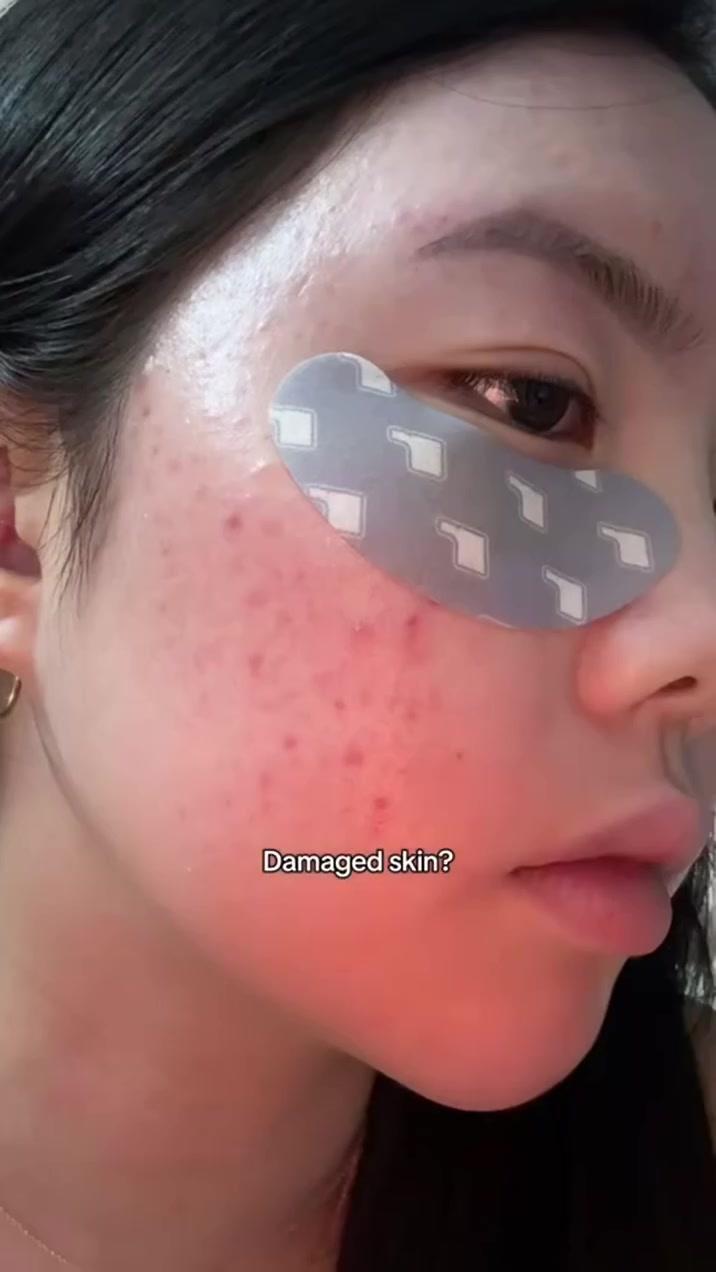 SKIN1004 Probio-Cica Enrich Cream 🇰🇷😌
 مرطب كوري مركز لإصلاح البشرة وتغذيتها عميقاً 😌😌
⭐️إصلاح الحاجز  يدعم ويقوي حاجز البشرة المتضرر. 
⭐️تهدئة فورية يقلل الاحمرار والتهيج الناتج عن الجفاف. 
⭐️ترطيب عميق يحبس الرطوبة بفضل السيراميد وزبدة الشيا. 
 نوع البشرة المستهدفة البشرة الجافة، الحساسة، أو المجهدة (مثالي بعد التقشير) 
 
يتوفر توصيل لجميع محافظات العراق 💜
#العراق #اكسبلور #صور #محافظات #كوزمتك #مجتمعات


**إذا كنت صاحب هذا الإعلان وتريد حذفه لأي سبب، رجاءا أرسل رسالة إلى الدعم الفني**