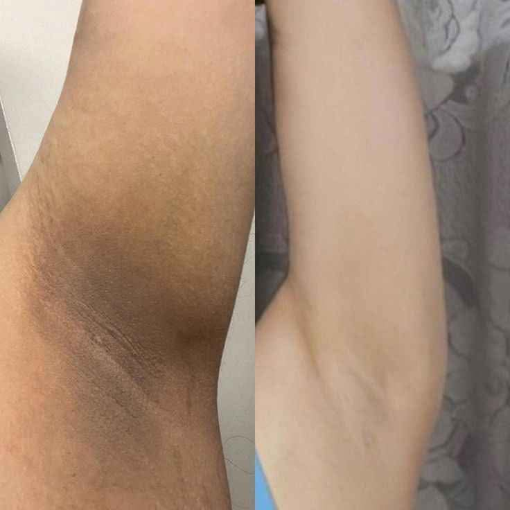 🌺عرض🌺 عناية بالمناطق الداكنة والحس،اسة 🫶🏻☺️
غسول تفتيح وتوريد المنطقة الحس،اسة 
كريم كنتا 
تفتيح المناطق  وتبيض ومعتلجة السمرار المناطق الداكنة 

عرض فقط علية 

توصيل مجاني 

سعر كلش مناسب  حسب طلبكم بغداد, العراق


**إذا كنت صاحب هذا الإعلان وتريد حذفه لأي سبب، رجاءا أرسل رسالة إلى الدعم الفني**