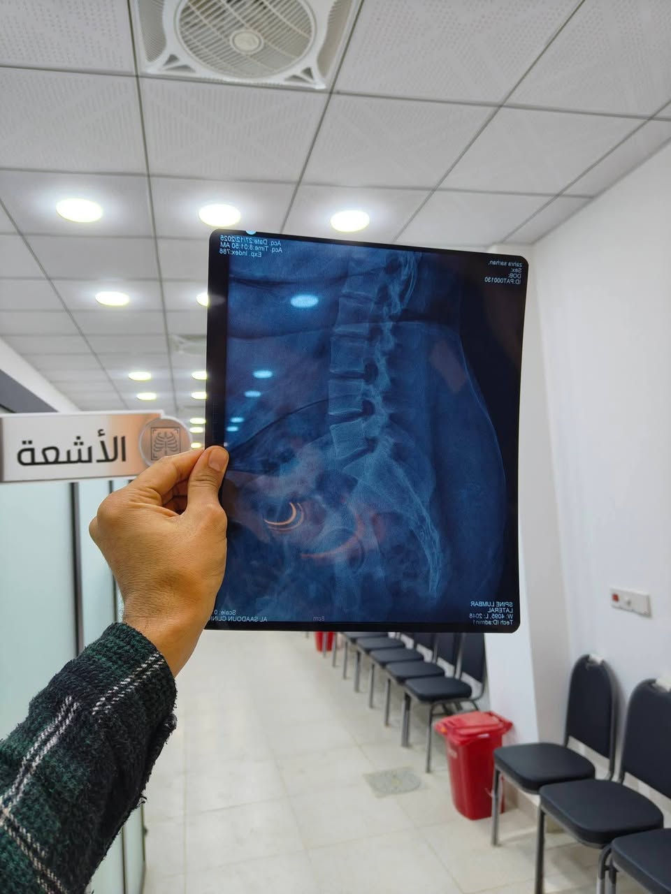 📢 #إعــــلان
يعلن مجمع السعدون الطبي عن تواجد

👩‍⚕️ الدكتورة فاطمة رشيد فليح

🦿🦾 أخصائية المفاصل والروماتزم والعلاج الطبي

🕒 أيام التواجد: الاربعاء ،الخميس، الجمعة من كل أسبوع  ساعة 4 الى 7  (عصراً)

كذلك  يعلن مجمع السعدون الطبي عن توفير اجهزة العلاج الطبيعي الحديثة ومن شركات معتمدة وتحت اشراف الدكتورة فاطمة رشيد فليح  

كما يعلن عن تشغيل أحدث جهاز للأشعة الرقمية DR

من شركة كيرستريم الأمريكية

للحصول على صور أشعة عالية وجودة ممتازة.

للحجز والاستفسار

***********

قلعة شكر / شارع الاطباء / مجمع السعدون الطبي
