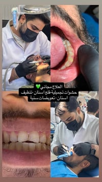 علاج مجاني • حشوات تجميلية • عيادات جامعة دجلة