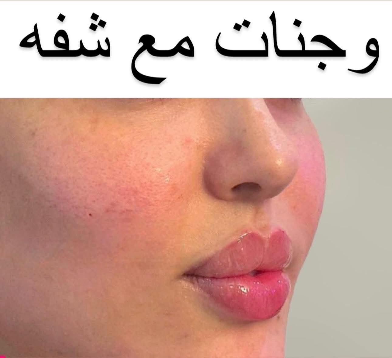 تغير شامل 150عشره سيسي مع ابرة نظاره هديه 💕💕💕💕💕💕


**إذا كنت صاحب هذا الإعلان وتريد حذفه لأي سبب، رجاءا أرسل رسالة إلى الدعم الفني**