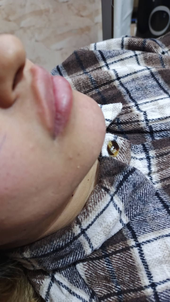 هلاو  بنات  عرض  العيد
فلر  شفه  الكوري ٣٠
 فلر  شفه  السويسري  ٤٠ 
فلر  شفه  الانكليزي  ٤٥ 
فلر  شفه  الايطالي  ٥٠
............. فلر الوجنات ........... 
فلر االخدود  الكوري  ٢٠  سي  الواحد 
فلر  الخدود  السويسري ٣٠ سي الواحد 
فلر  الخدود  الانكليزي  ٣٥  س الواحد 
فلر  خدود اليطالي ٤٠  س  واحد 
كل  اثنين  اخوات  او  صديقات  تاخذون  سيسي  مجاني  
..................... ابرةالنظاره ...... 
عرض  ابرة  الرتفال  ٢٥  
ابرة  العنبر  + ابلازمه  ٣٠ 
ابرة  طماطه  +  تنضيف  بشره  عميق  ٢٥ 
 ابرة  العروس  +  الفيتامين  سي  ٢٥ 
 ........................مكس  الايطالي  الخاص بدكتورا  ٥٠ الف  
تنضيف بشره  عميق هديه  
كل  اثنين  صديقات  او اخوات  الهم  هديه بختيارهم  من  داخل  صالون  
 ........ تغير شامل  الفلر  كوري  ١٠
يشمل  الخدود 
تكساس  
ذقن  
اصداع  
شفه  
150الف  
............. تغير شامل  الفلر  الاسويسري  ....... 
الخدود  
تكساس  
ابرزاز  ذقن  
اصداع  
شفه 
........... 200الف  +  اابرة الفيتامين سي هديه 
 ....... تغير شامل  الفلر  الايطالي  ....... 
الخدود 
تكساس  
ابراز  ذقن  
اصداع  
شفه 
250الف   +  ابرة العنبر  +بوتوكس  سحب  الحاجب


**إذا كنت صاحب هذا الإعلان وتريد حذفه لأي سبب، رجاءا أرسل رسالة إلى الدعم الفني**