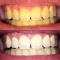 العلاج مجاني • عيادات الجامعة الاسلامية • الميدينة القديمة