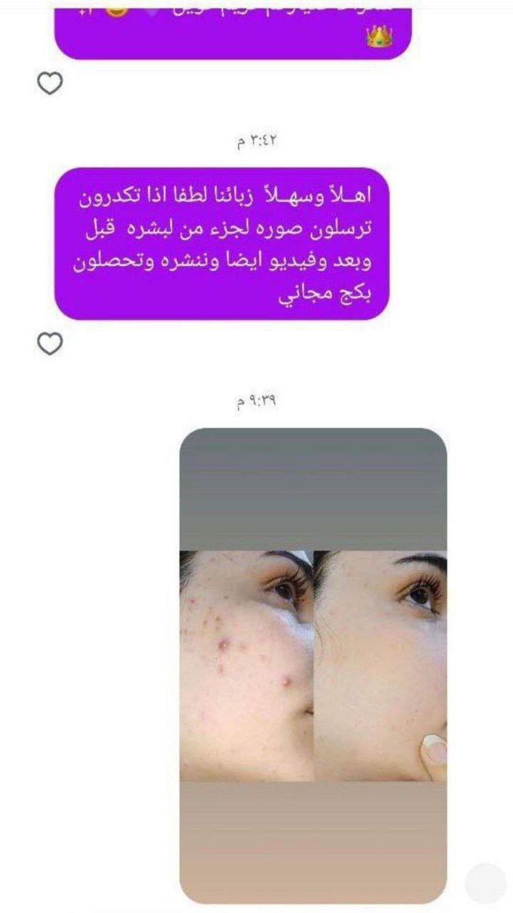 للحجز دايريك او واتساب  ***********😍◀️ بكج العناية الكاملة بالبشرة من كوين سنتر والمناسب لكلا الجنسين 💯
⚘️ كريم كوين الليلي +وسيروم فيتامين c + صابونه الكولاجين ⚘️

راح تلاحظون تغيير سحري بشرتكم من اول اسبوع 🥰👌
💢 مع ضمان 

 تلاحظون نتيجة خلال 7 ايام 💢
 #كوين_سنتر 🥰👌

للطلب والاستفسار يرجى مراسلة الصفحة
للحجز دايريك او واتساب  ***********�
