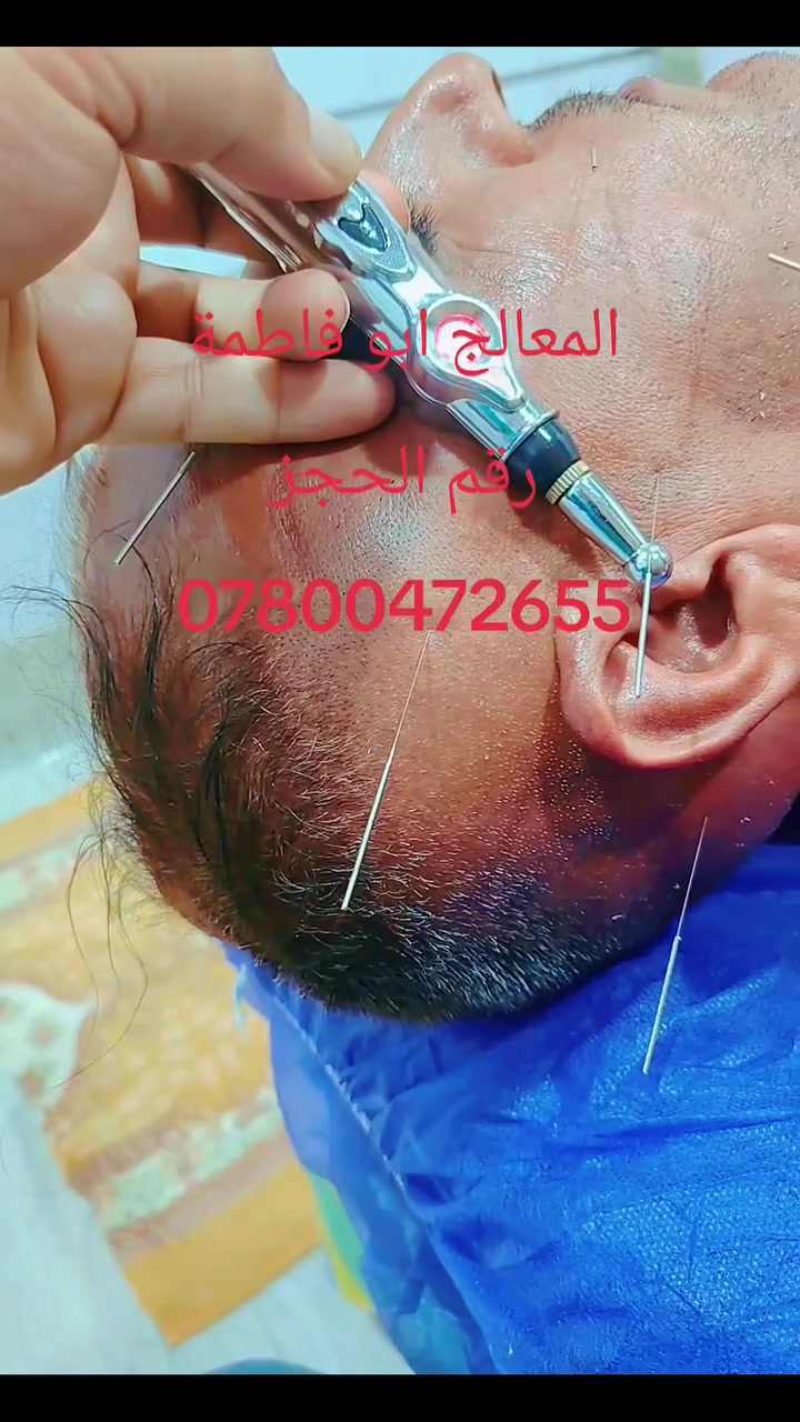 #لايك #عجاب #مشاركة
#لصفحه
المعالج والحجام ابو فاطمة 
#رقم # الحجز ***********
