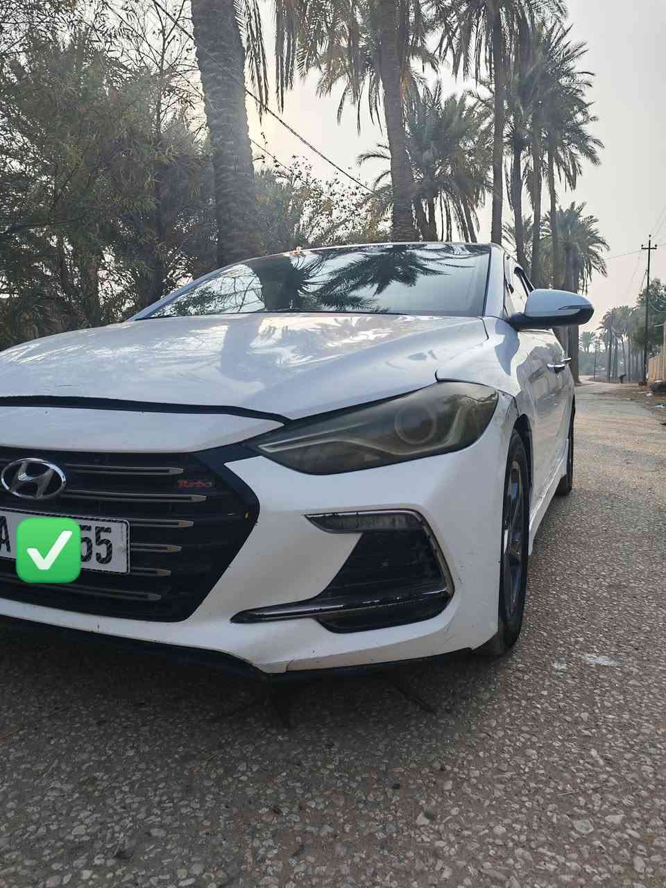 سلام عليكم النترا موديل 2017وارد أمريكي فتحه بل قماره مري شفط تحكم ستيرن محرك 1400تيربو قتصادي كير عادي 6نمر  السعر 95وبيه مجال مكان نجف الستفسار أكثر ***********
