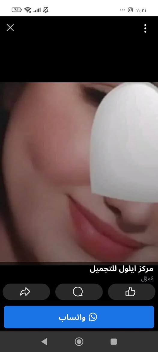 اقوى خلطة تبيض  وجه معجزه امانه الله 

اقوئ العروض وتخفيضات مده يومين تحطيم اسعار سعر جمله منتج يخبل والله العظيم

مخلوطه من18نوع من كريمات طبيه  بنوعيتين مسمن وبدون مسمن مورد وبدون مورد يستخدم للوجه والجسم بنفس وقت 
كلف نمش حب الشباب تصبغات هالات تحت العين  
  والاسعار ويانا نار 🔥

نتائج واضحة بيومين  من الاستعمال
فوائد الخـــلطــــــة

  ازالة التصبعات
- ازالة اكلف والنمش
- ازالة التجاعيد ( ان وجدت )
- ازالة هالات السوداء تحت العين 
-  تضيق المسامات
- ازالة حب الشباب  واثاره
🌹🌹🌹🌹🌹🌹🌹
خلال ثلاث ايام مفعول ملحوظ جدا 

امانه الله مجربه مضمونه وعن تجارب السعر  20  توصيل مجاني 

الحجز مراسلة الصفحة
التوصيل مجاني لكافة محافظات العراق


**إذا كنت صاحب هذا الإعلان وتريد حذفه لأي سبب، رجاءا أرسل رسالة إلى الدعم الفني**