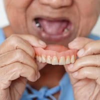 قلع أسنان مجاني • طقم أسنان متحرك • عيادات الكفيل