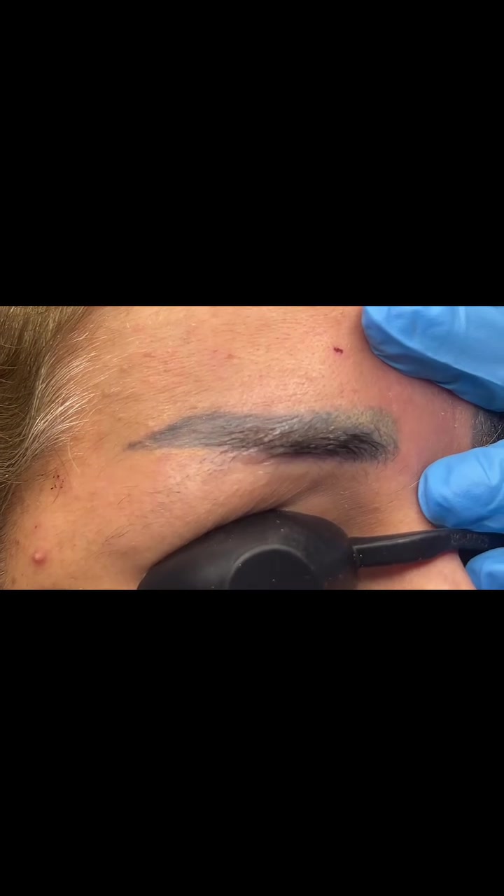 #عرض_خاص 
@ڪل 3 جلسات 125 الف 

#جهاز_الفي_ليزر  pHI LAser
الجهاز الاحدث عالمياً والاول  بالشرق الاوسط
من أقوى انواع الليزر .. يزيل التاتو الغامق و الفاتح  والوشم بڪل انواعها 

دائما نحب نوفرلكم الافضل ✅✅
للحصول على افضل النتائج ✅✅✅💎💎💎

لازالة التاتو والوشم بعدد جلسات اقل ونتائج مضمونه ✅✅

يعمل جهاز الفي ليزر ع استهداف صبغة التاتو فقط💎💎💎

من دون الحروق او تلف للجلد بل يعمل ع تحفيز الشعر وترميم  الجلد✅✅✅

🔘 
‏مـــــــــع رينا لليزر والتجميل 
🔻
⛳️ العنوان / داخل مجمع علم الكندي الطبي التخصصي/ قريب من البوابة الجديدة/ قريب من أسواق زاد الخير 
        
📲 للحجز والاستفسار 
***********
( متوفر واتساب )
