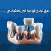 تركيبات أسنان • الناصرية المنصورية • تقسيط بدون فوائد