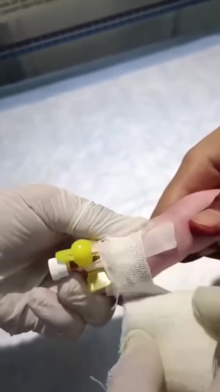 عيادتي ترحب بكم عيادة تمريضيه وحجامه فيهاااا للنساء والرجال... العنوان سامراء مدخل دوانم المعمل قرب صيدلية الأصيل وات ساب للعيادة ***********===مراسله فقط..غدا صباحا يوجد حجامة لكلا الجنسين
