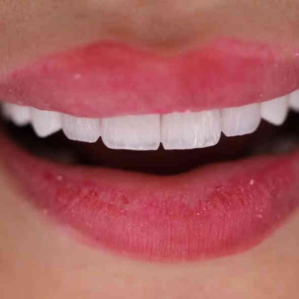 مركز اوتار كلنك لطب الأسنان والتجميل 
ابتسامة هوليود بتفاصيل تتناسب مع لون البشره 
الابتسامة الصح بالمكان الصح 
العنوان الشموخ خلف مكتب الحنين للعقار داخل الفرع 📍 
للحجز ***********
