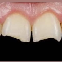 مجانا • حشوات ضوئية • كربلاء