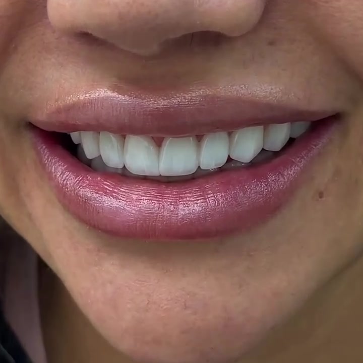 ✨ ابتسامتك... سرّ جمالك ✨
في مركز سما المناذرة لطب الأسنان
نمنحك ابتسامة مشرقة بأساليب علاجية حديثة ورعاية احترافية.
🦷 خدماتنا:

تنظيف وتبييض الأسنان
حشوات تجميلية
تقويم الأسنان
زراعة الأسنان
تركيبات ثابتة ومتحركة
علاج العصب وخلع الأسنان

📍 مركز سما المناذرة لطب الأسنان
ابتسامتك تبدأ من هنا... لأنك تستحق الأفضل.
احجز موعدك الآن، ودعنا نهتم بابتسامتك بكل ثقة. 🌟

العنوان / النجف الاشرف _ المناذرة _ الشارع العام _ قرب مستشفى
 المناذرة _عمارة الحاج ابو نبيل جانب صيدلية الأصالة
 للحجز والأستفسار / ***********
الساعه 9:00 صباحا الساعه 1:00 ظهرا من الساعه 3:30 ظهرا الى الساعه 9:30 ليلا ًَ
#تقويم_اسنان 
#زراعة_الاسنان
 #ابتسامة_هوليود 
#مراكز_الشركة_الطبية_العالمية
 #تغليف_اسنان
